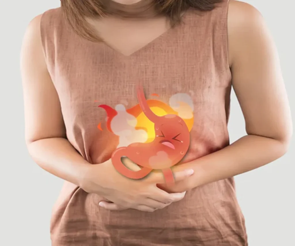 Gastric Troubles Homeopathic treatment